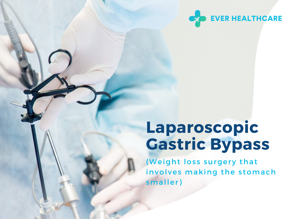 Laparoscopic Gastric Bypass in Thailand 2022 Compare Price & Reviews
